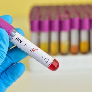 Hand holding blood test vial marked as HIV negative