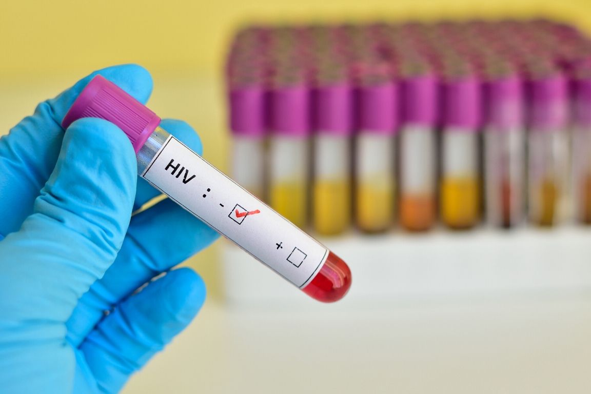 Hand holding blood test vial marked as HIV negative