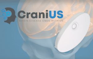 Opening a New Frontier in Drug Delivery to the Brain: Featuring CraniUS CEO, Michael Maglin 