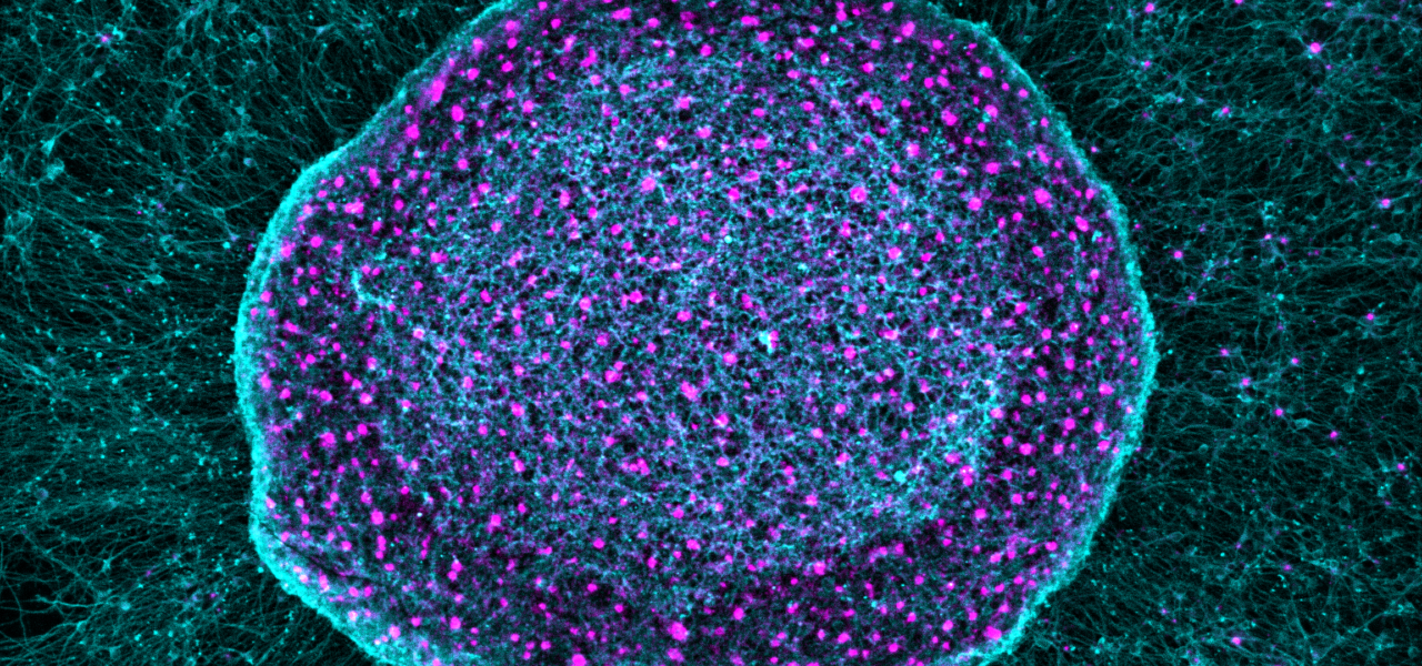 Baltimore Startup Closer to Opioid-free Pain Treatment with First-of-Its-Kind Cell Therapy That Absorbs Pain Signals