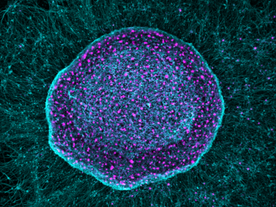 Baltimore Startup Closer to Opioid-free Pain Treatment with First-of-Its-Kind Cell Therapy That Absorbs Pain Signals