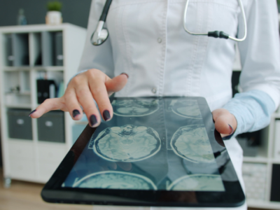 Baltimore’s CraniUS Therapeutics Wins FDA Clearance for Its Patient-Specific Cranial Implant