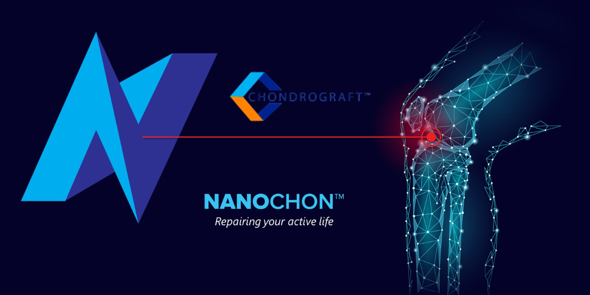 Baltimore’s Nanochon Treats First Patient in Chondrograft™’s First-in-Human Trial