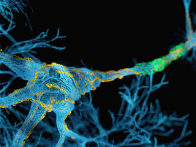 Penn and Miami Launch $26 Million NIH Study to Detect ALS and FTD Before Symptoms Appear